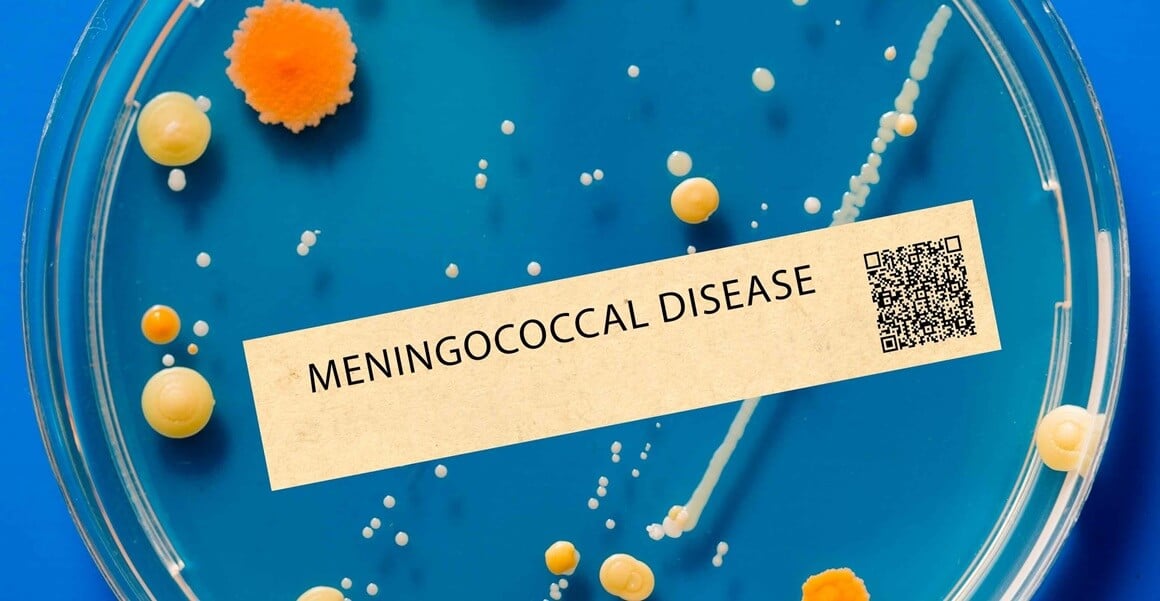Meningokokna sepsa - dijagnoza