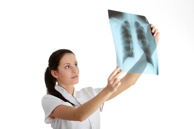 Upala pluća kod djece (pneumonija) – uzroci, vrste, simptomi i liječenje
