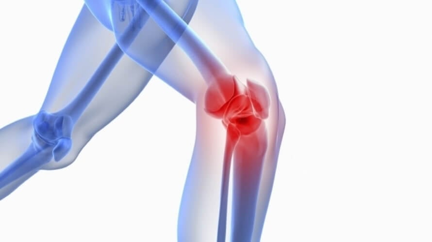 artroza liječenja zgloba koljena injekcijama hijaluronske kiseline bol u zglobu koljena i gležnja