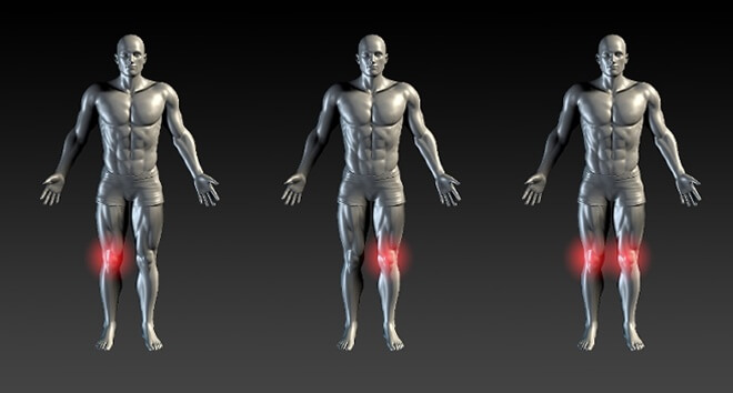 krckanje zglobova i bol nego za ublažavanje bolova u zglob joint