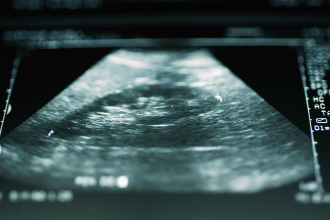 nalaz ultrazvuka