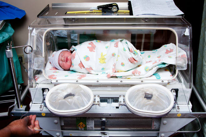 novorođenče u inkubatoru