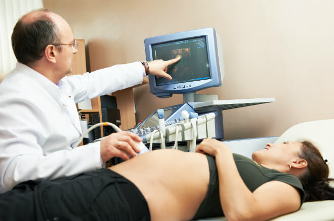 ultrazvuk