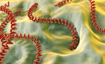 Leptospiroza