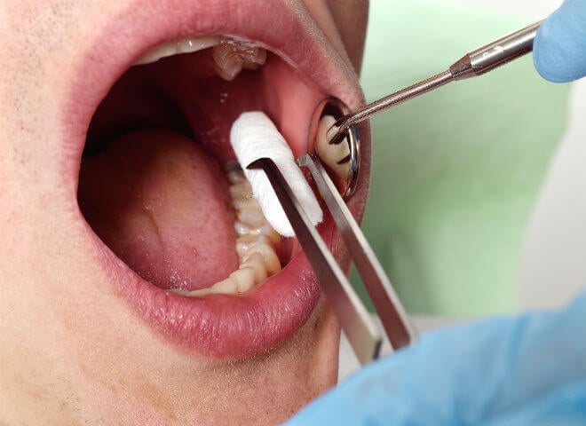 pregled kod zubara