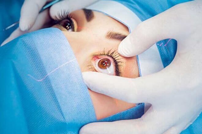 Operacija oka