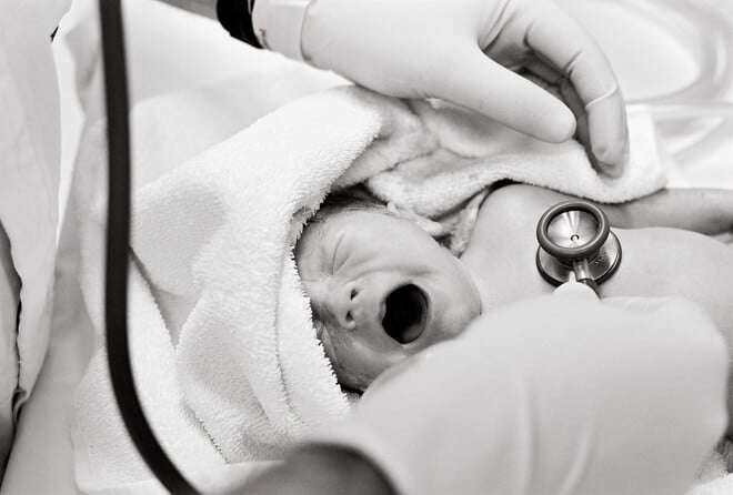 žutica kod novorođenčadi dijagnoza