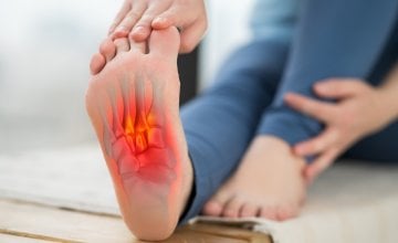 Plantarni fascitis Zašto vas peta boli pri prvim jutarnjim koracima