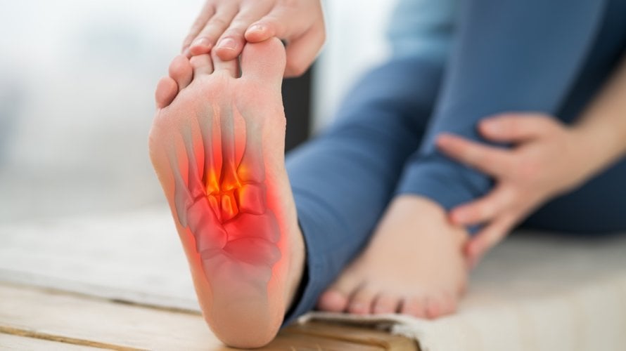 Plantarni fascitis Zašto vas peta boli pri prvim jutarnjim koracima