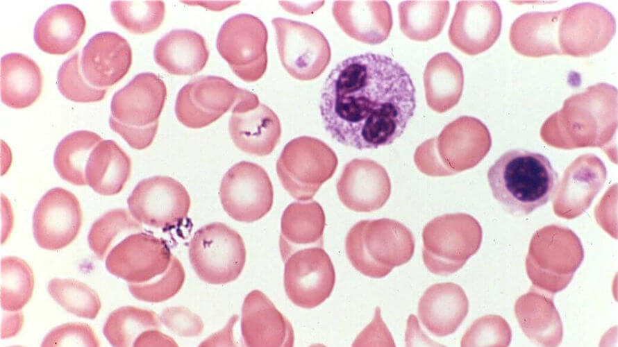 krv pod mikroskopom