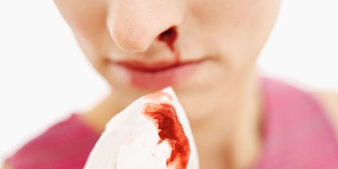 Hipertenzija recidivirajuće krvarenje iz nosa