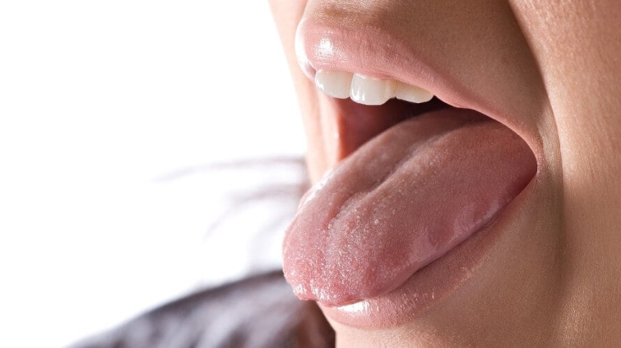 Bolan jezik – vrste, uzroci i simptomi | Kreni zdravo!