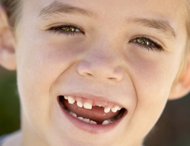 Mliječni-zubi-ispadanje