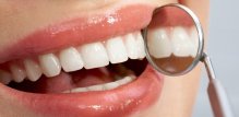 aktivni ugljen za zube
