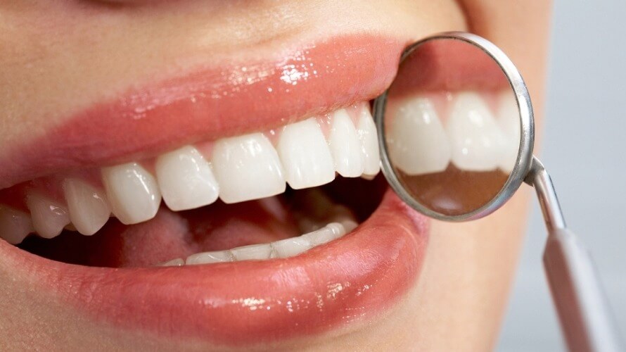 aktivni ugljen za zube
