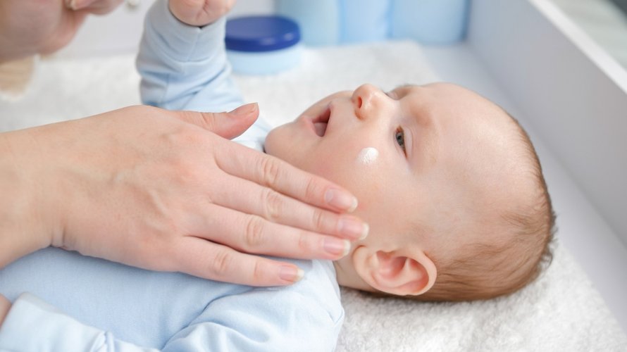 Suha koža kod beba