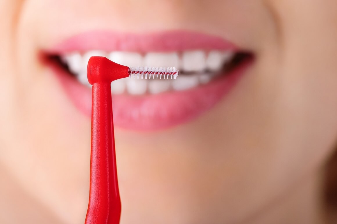 Interdentalne četkice su izvrsno rješenje za pranje prostora između zubi