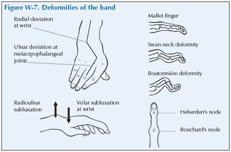 deformiteti ruke