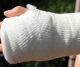 Prijelom palčane kosti