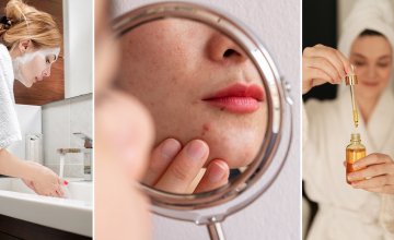 Koži sklonoj aknama i osjetljivoj koži zajedničko je da traže posebnu njegu i proizvode koji neće pogoršavati stanje