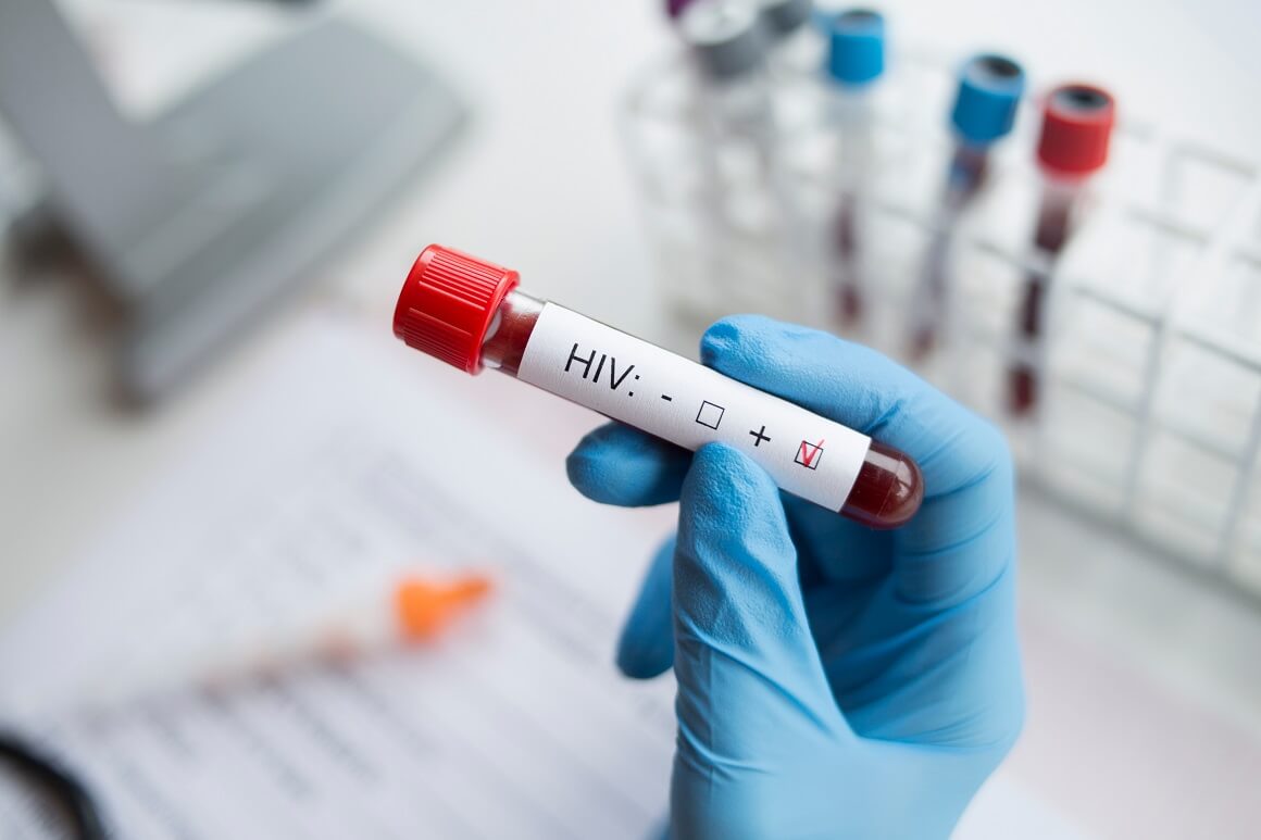 Testiranje za HIV