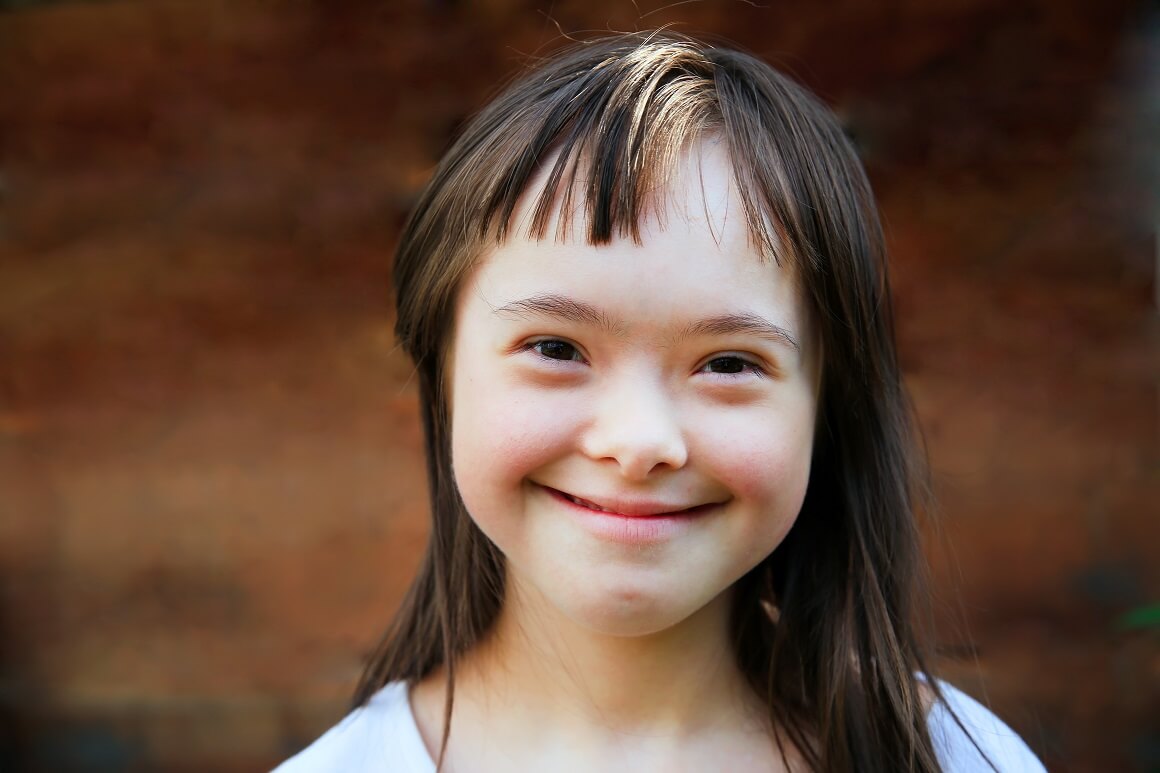 Ponašanje djece s Downovim sindromom