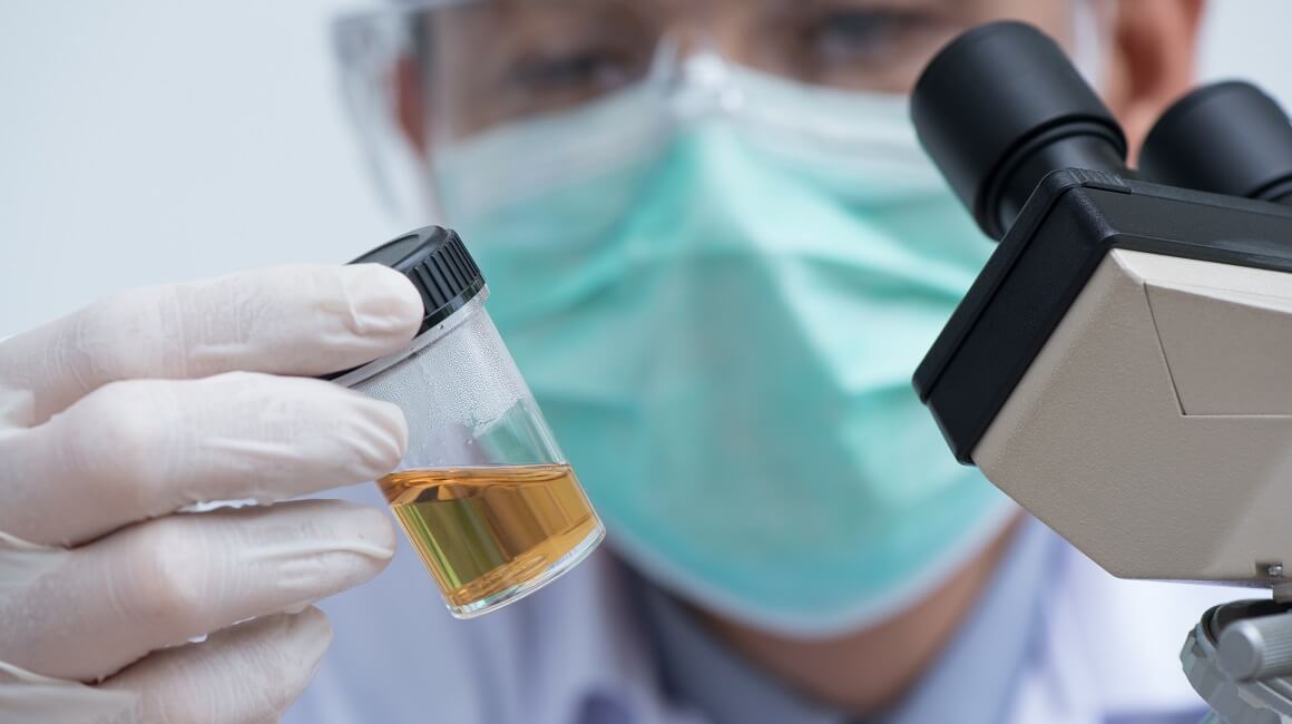 Znanstvenici budućnost poljoprivrede vide u zamjeni kemikalija ljudskim urinom