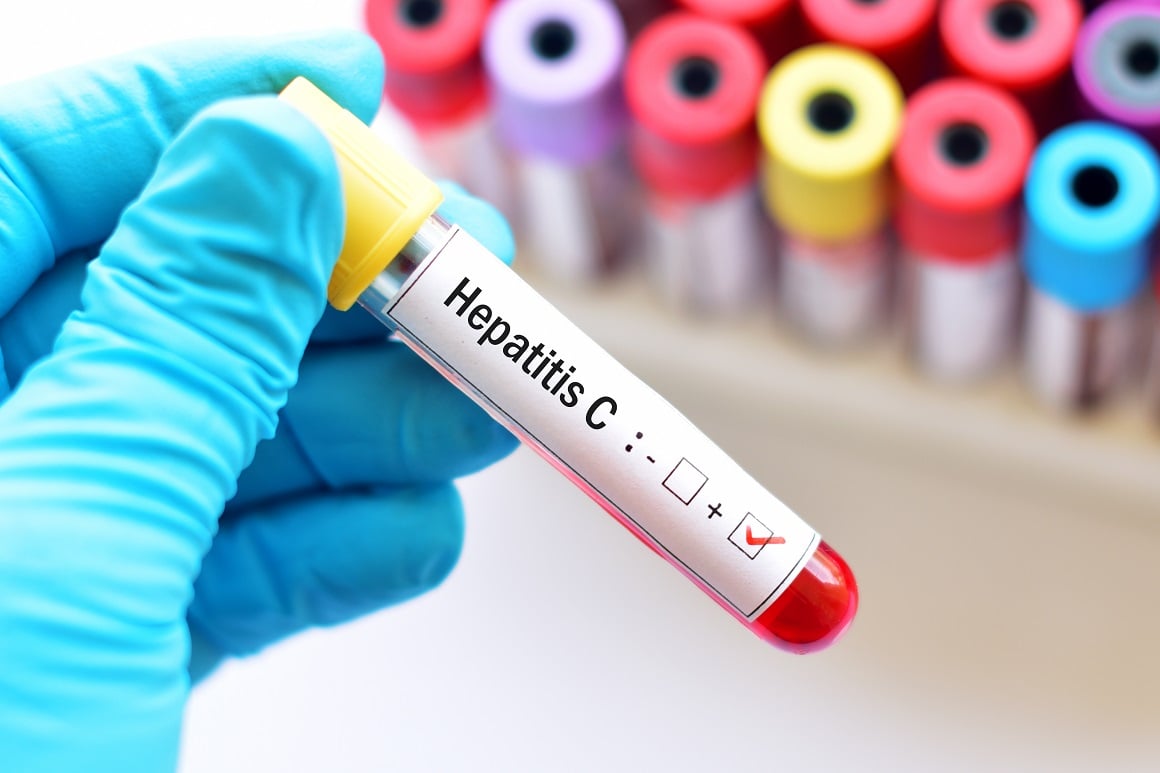 Posljedice hepatitisa C