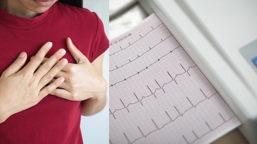 Svaka 4. osoba će tijekom života imati problema s nepravilnim ritmom srca