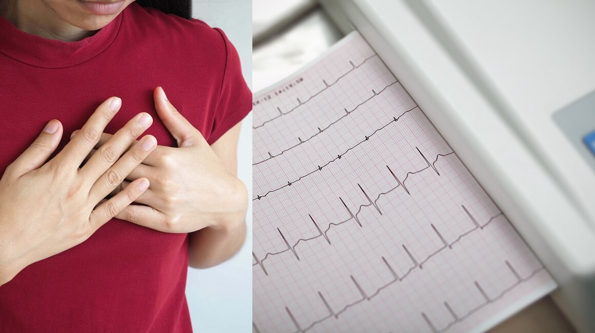 Svaka 4. osoba će tijekom života imati problema s nepravilnim ritmom srca