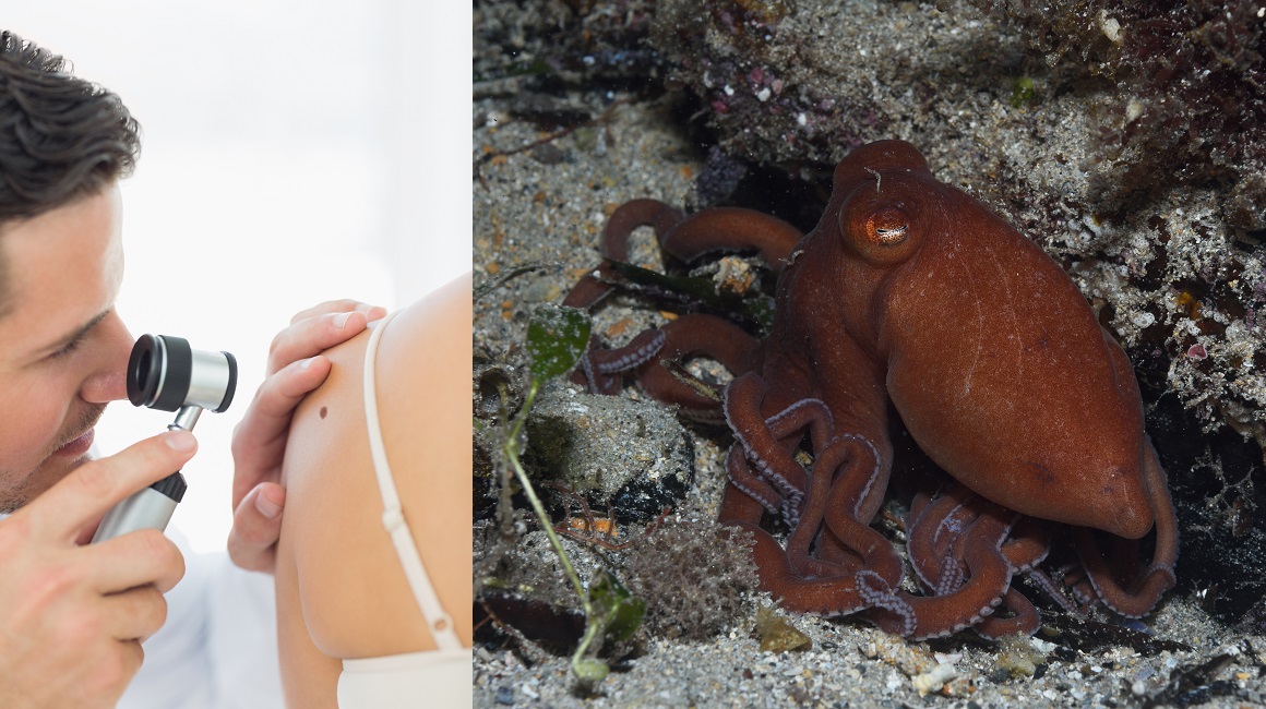 Otrov australske hobotnice mogao bi biti ključan u borbi protiv melanoma