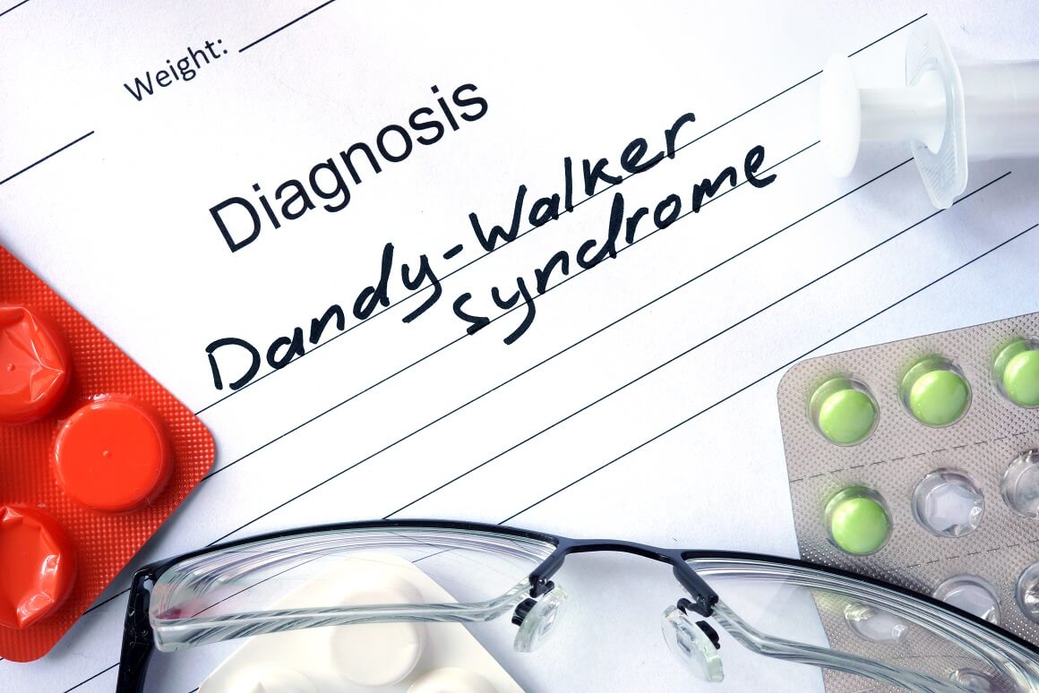 Liječenje osoba s Dandy-Walkerovim sindromom općenito se sastoji od liječenja prisutnih problema