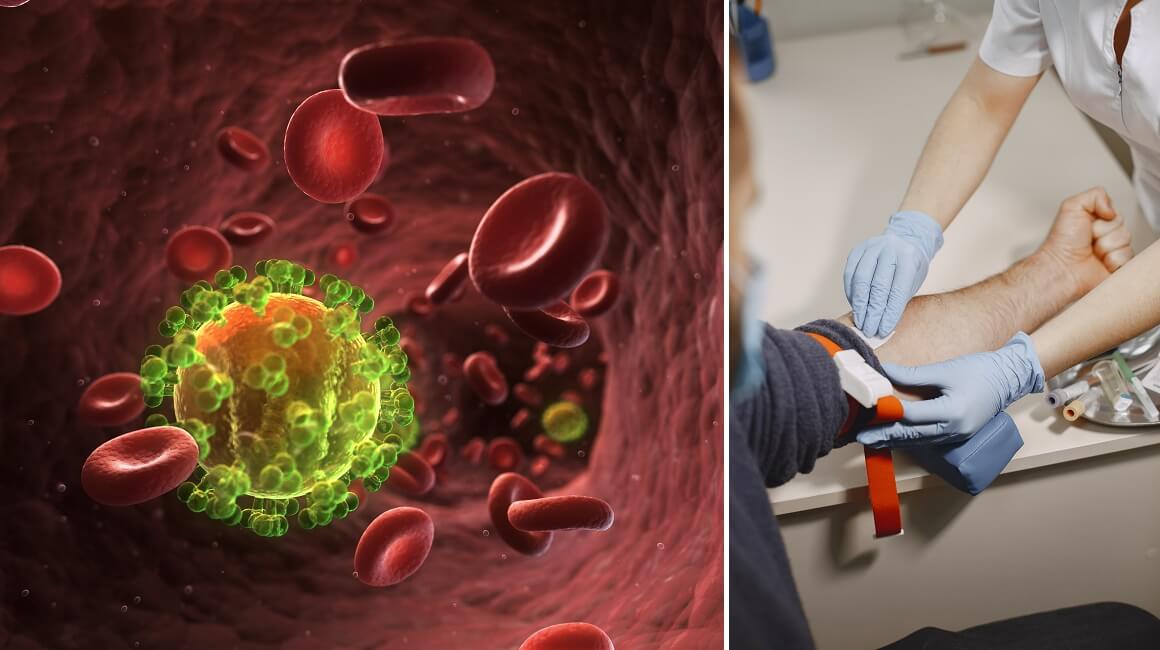 Muškarac je izliječen od zaraze HIV-om nakon transplantacije matičnih stanica