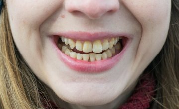 Zubi s vremenom mijenjaju boju i normalno je da s godinama gube bjelinu, a kava, čaj, crno vino i pušenje najčešći su uzroci diskoloracije