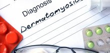 Dermatomiozitis je bolest koja uzrokuje kroničnu upalu i slabost mišića