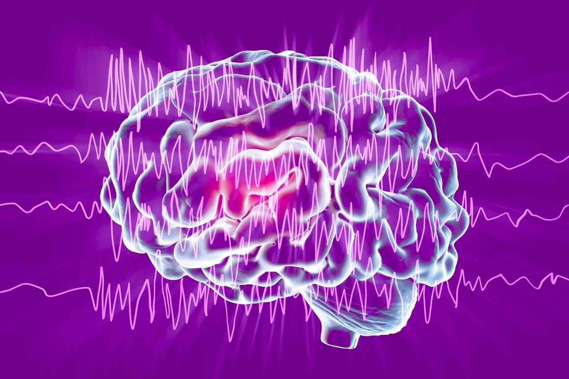 Epilepsija pogađa oko 50 milijuna ljudi diljem svijeta