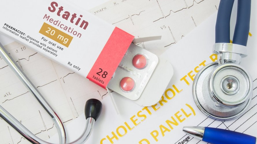 Statini su najčešće propisivani lijekovi za snižavanje kolesterola