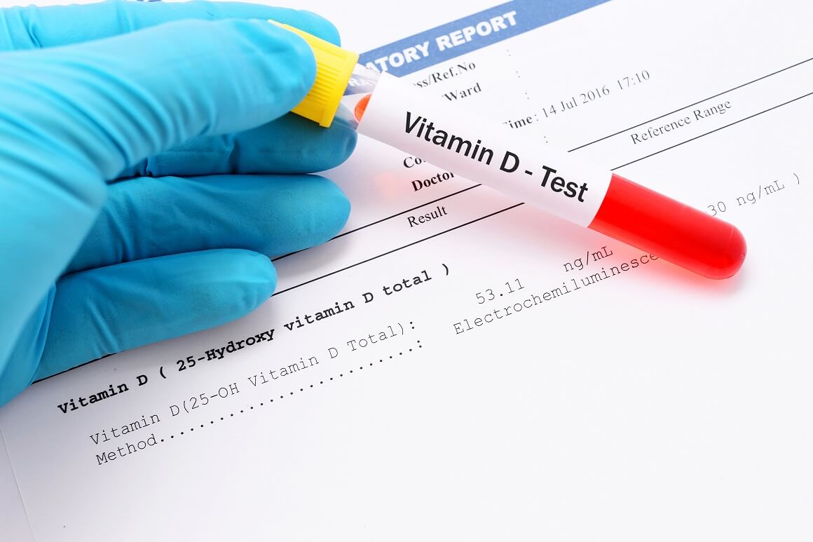 Stručnjaci za prehranu sugeriraju da se osobe koje žele početi uzimati suplemente vitamina D prethodno posavjetuju s liječnikom