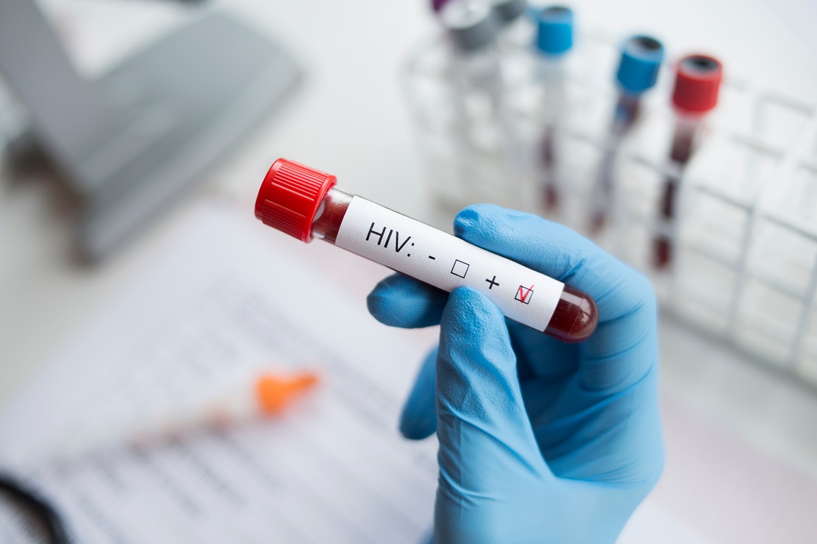 HIV nemjerljiv = nezarazan