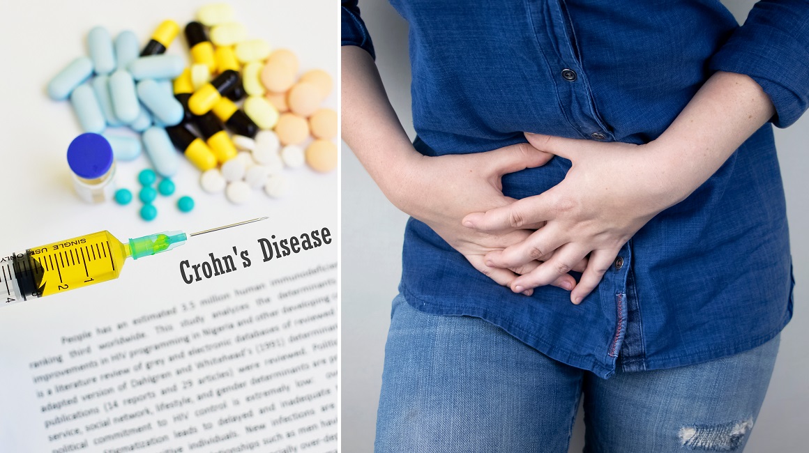 Novi lijek za Crohnovu bolest