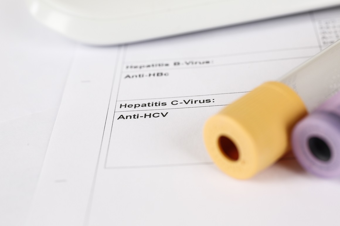 Hepatitisi su još uvijek globalni javnozdravstveni izazov