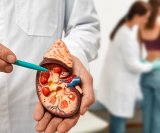 Najčešće bolesti bubrega