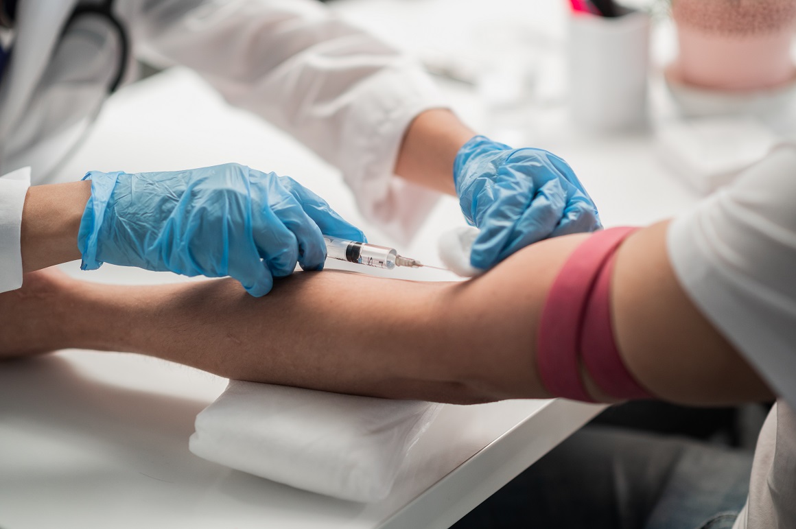 Krvni testovi nude potencijal za poboljšanje točnosti i praktičnosti dijagnosticiranja i praćenja Alzheimerove bolesti
