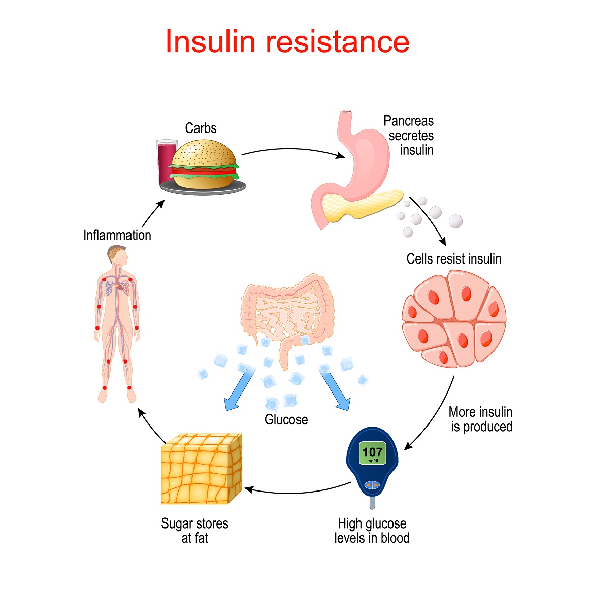 Ako tijelo postane otporno na inzulin, to otežava ulazak glukoze u stanice, što dovodi do visoke razine šećera u krvi