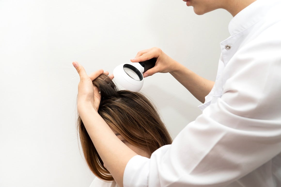 Bez obzira na fazu ćelavosti, ključno je potražiti savjet dermatologa ili trihologa koji se bavi gubitkom kose