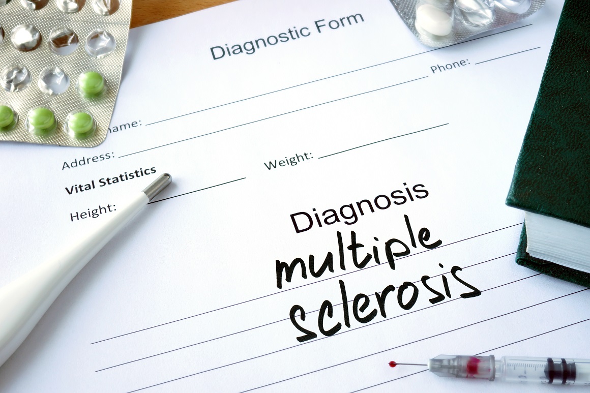 Dijagnoza multiple skleroze