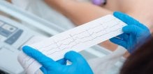 EKG ili elektrokardiogram je obavezan dio kardiološkog pregleda koji daje grafički zapis električnih potencijala srca