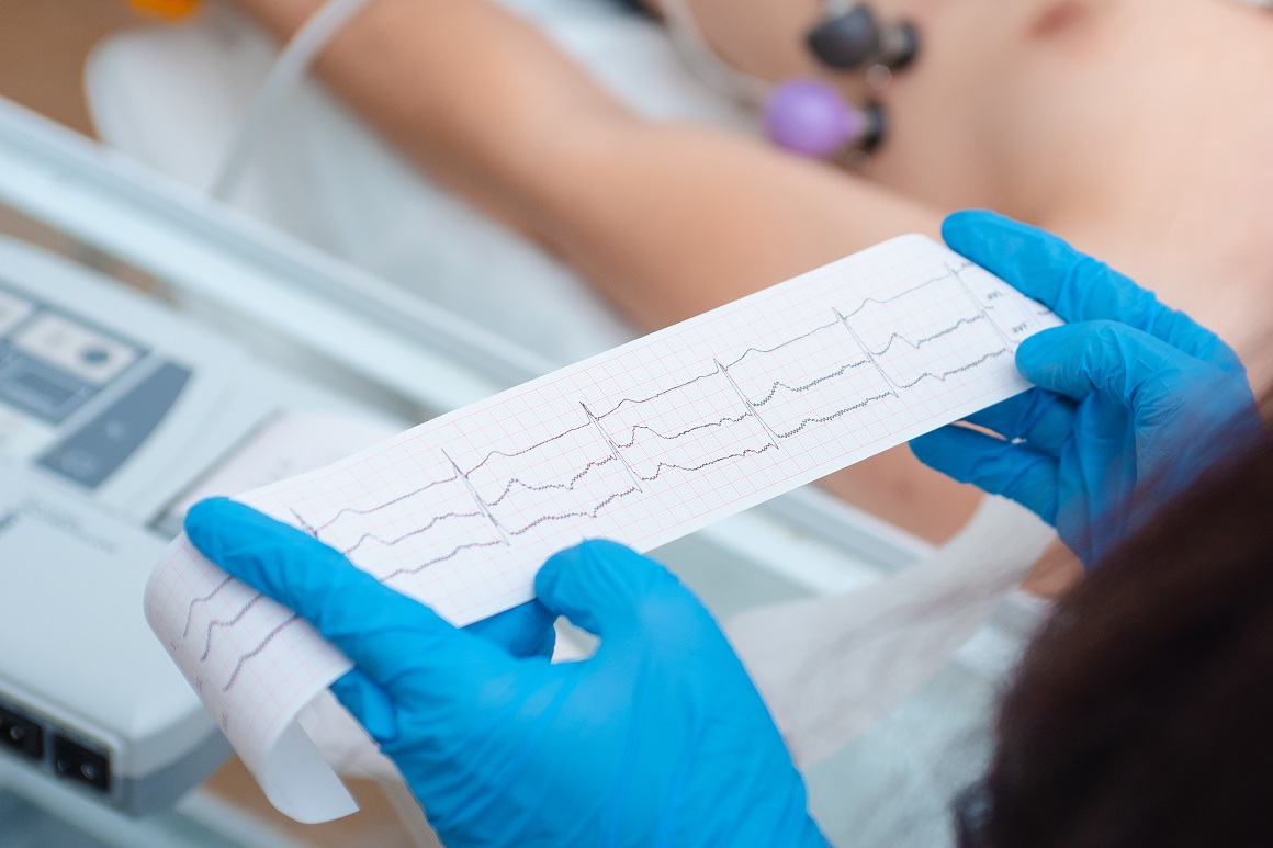 EKG ili elektrokardiogram je obavezan dio kardiološkog pregleda koji daje grafički zapis električnih potencijala srca