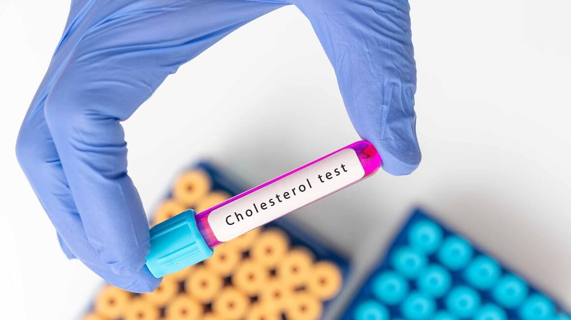 Prvi oralni lijek za loš kolesterol snižava razine za 65 %