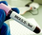 BRCA testiranja zaista mogu pomoći zdravim ženama da utvrde visoki rizik od razvoja raka dojke i raka jajnika